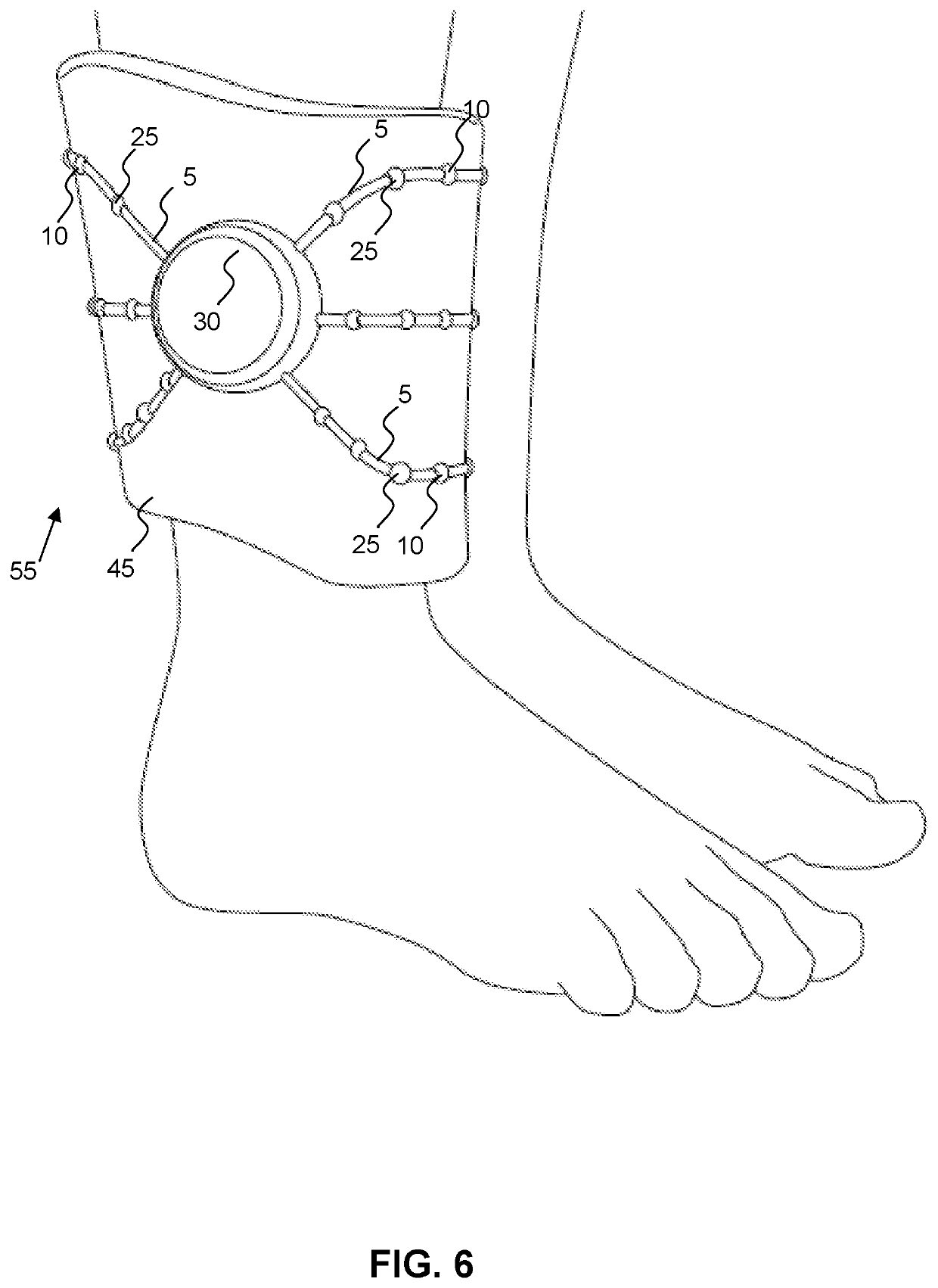 Intelligent Stop Shaking Device, System and Method