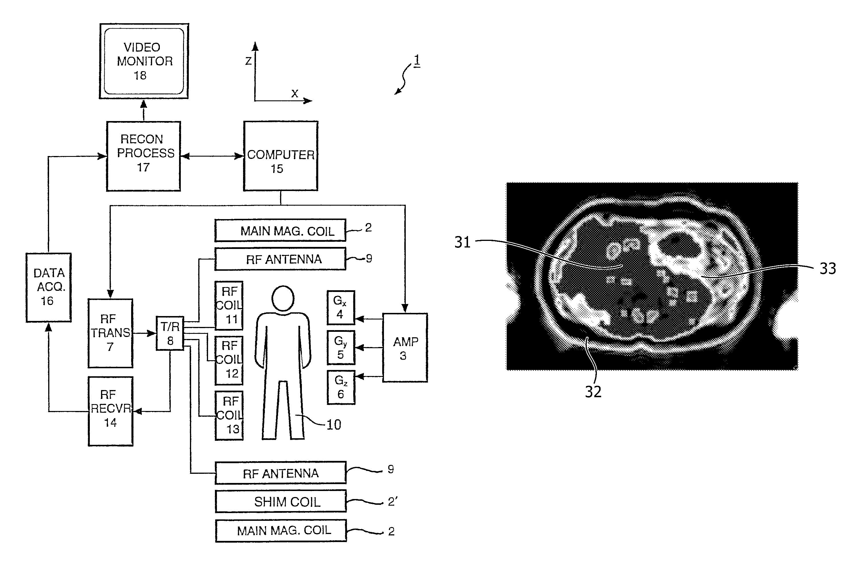 MR imaging using a multi-point dixon technique