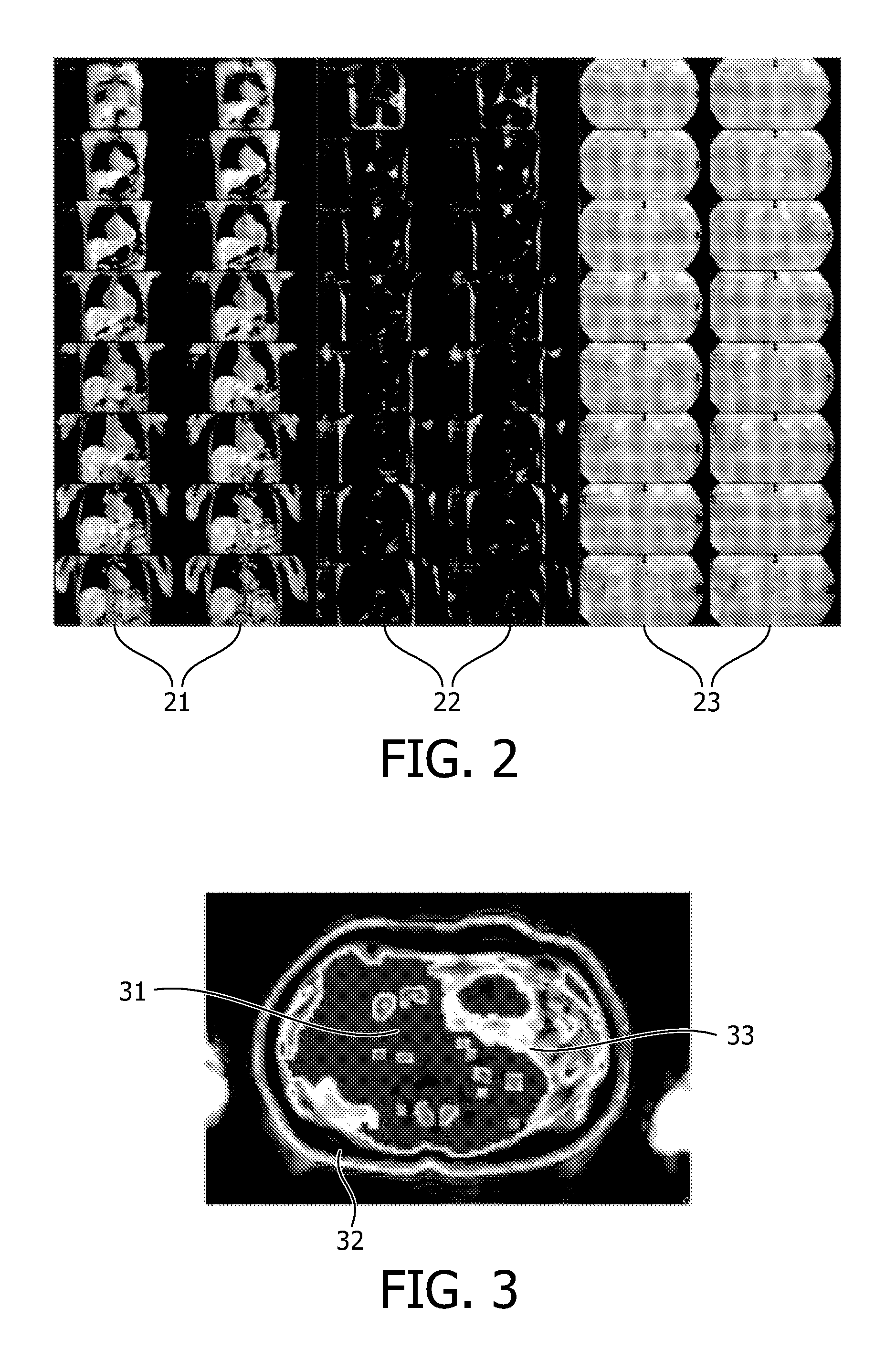 MR imaging using a multi-point dixon technique