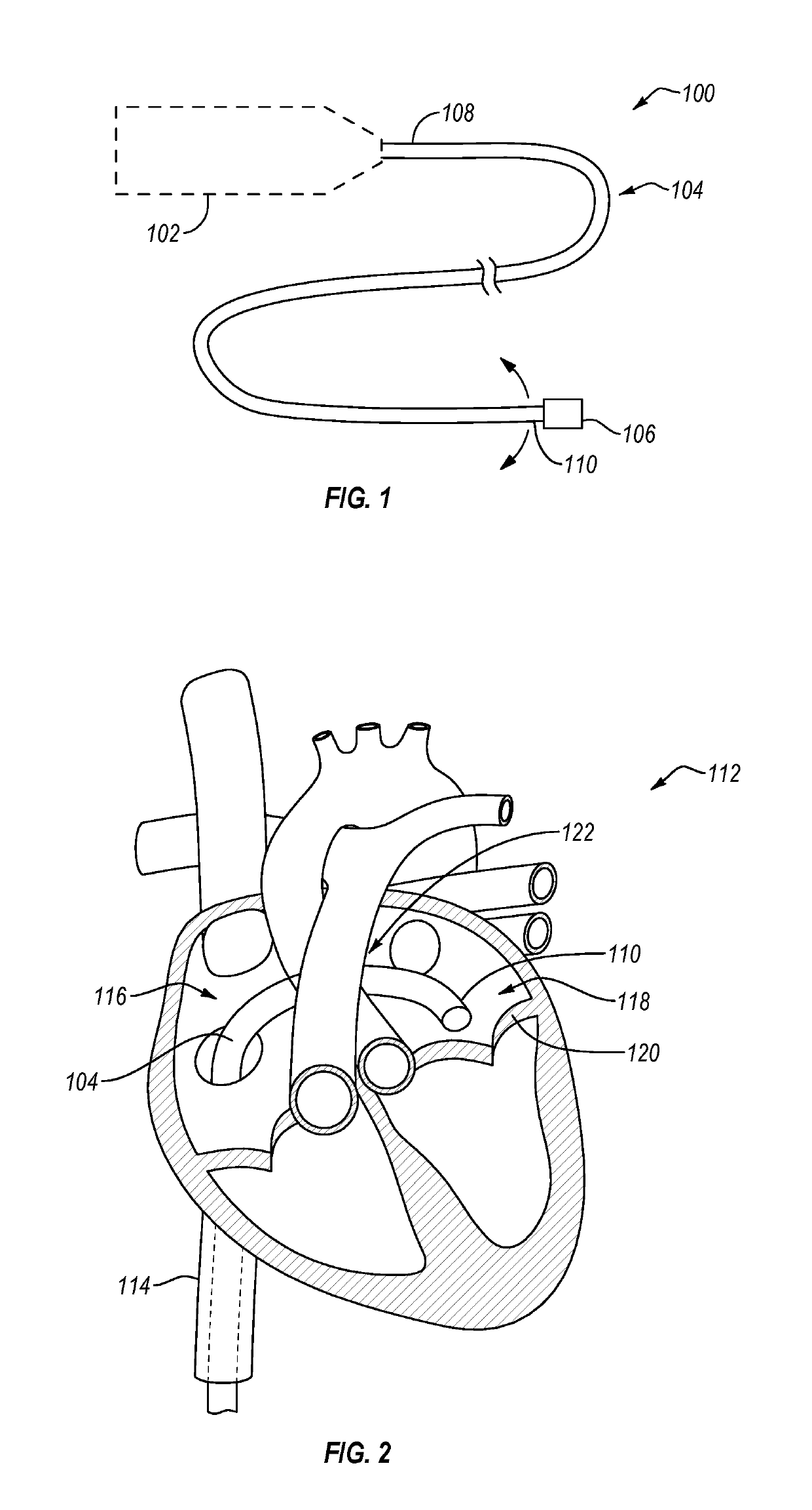 Cardiac implant delivery system