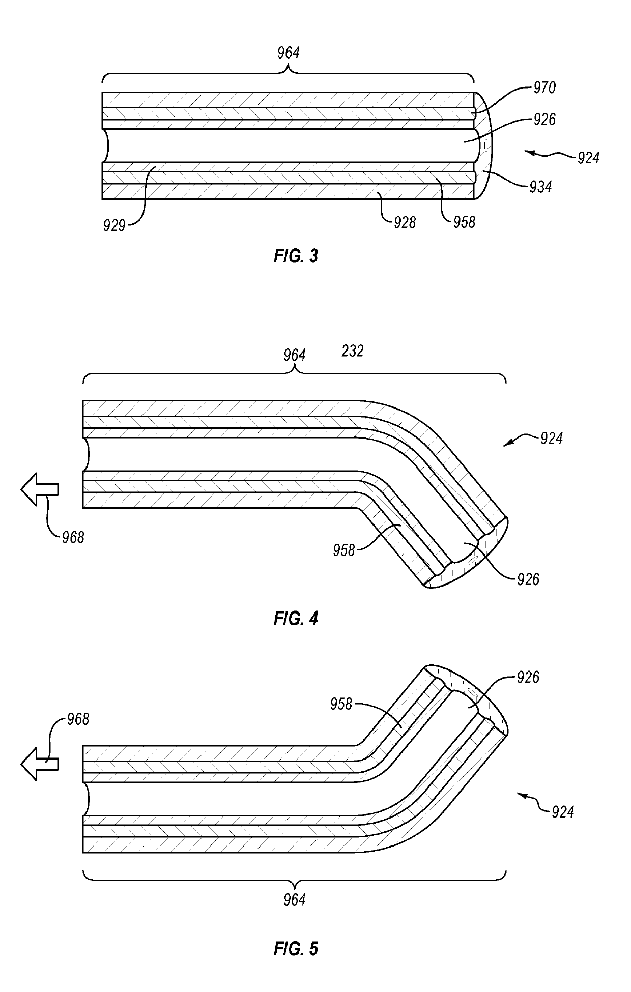 Cardiac implant delivery system