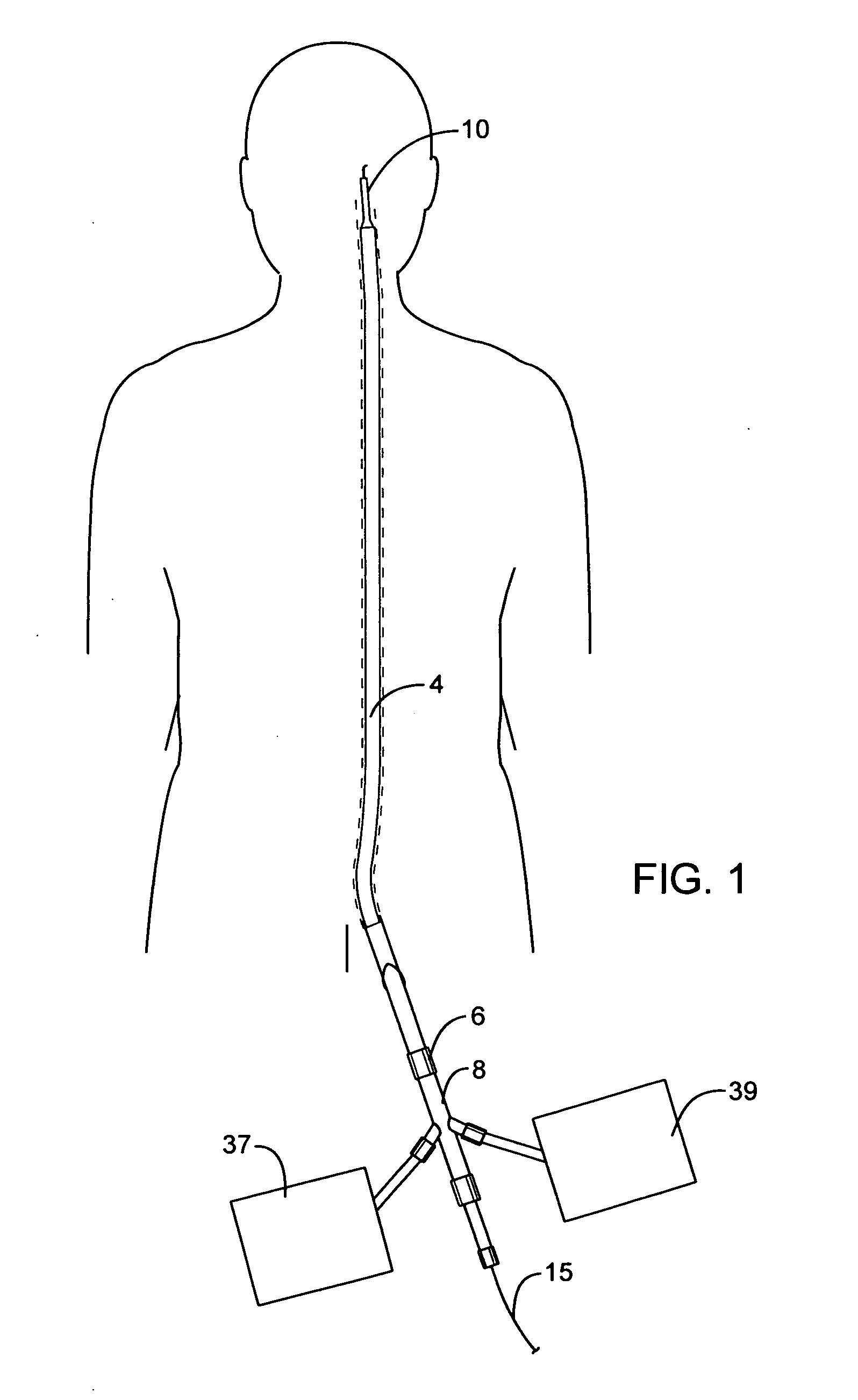 Methods and devices for protecting a passageway in a body when advancing devices through the passageway