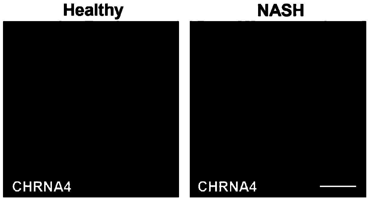 Application of CHRNA4 in preparation of drugs for treating nonalcoholicity steathopatitis