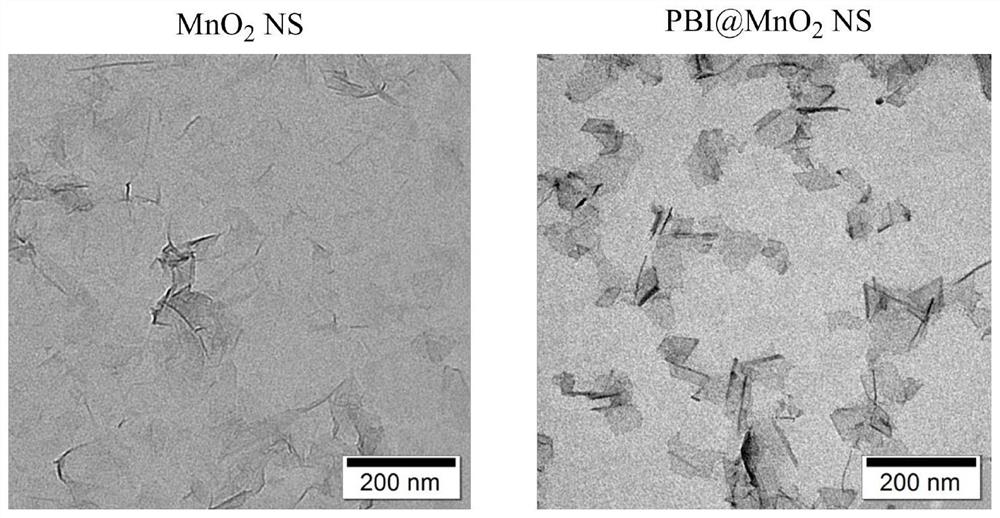 A fluorescent probe for detecting acetylcholinesterase activity and its synthesis method and application