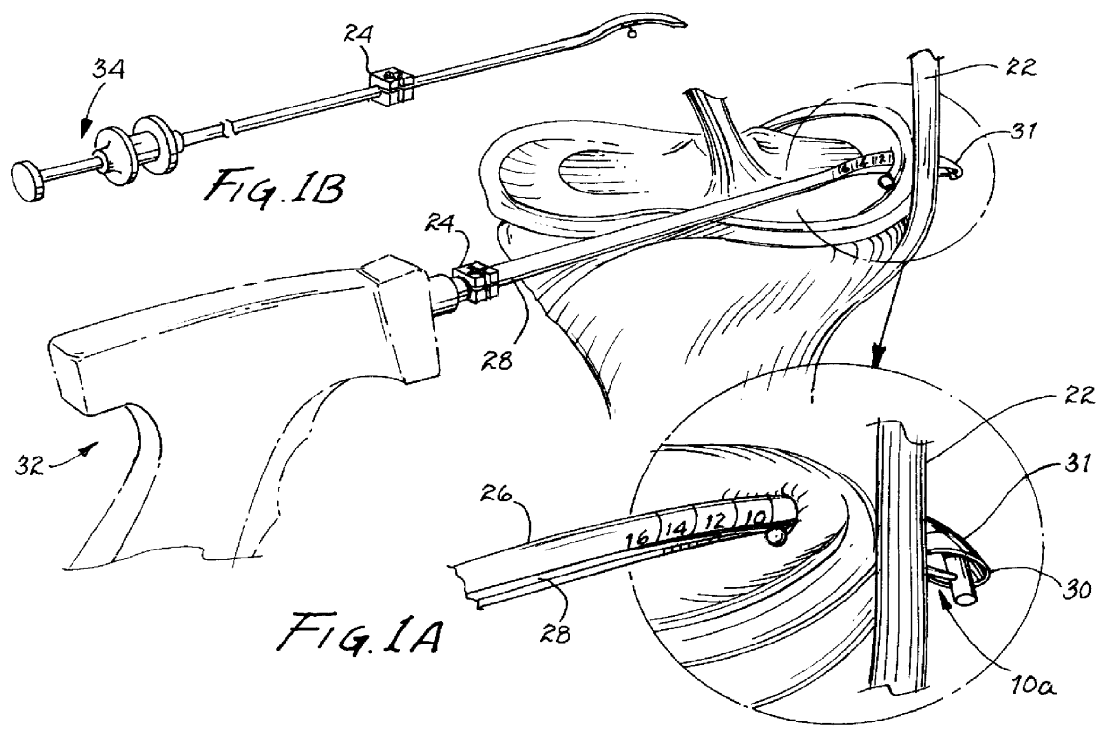Single unit surgical fastener and method