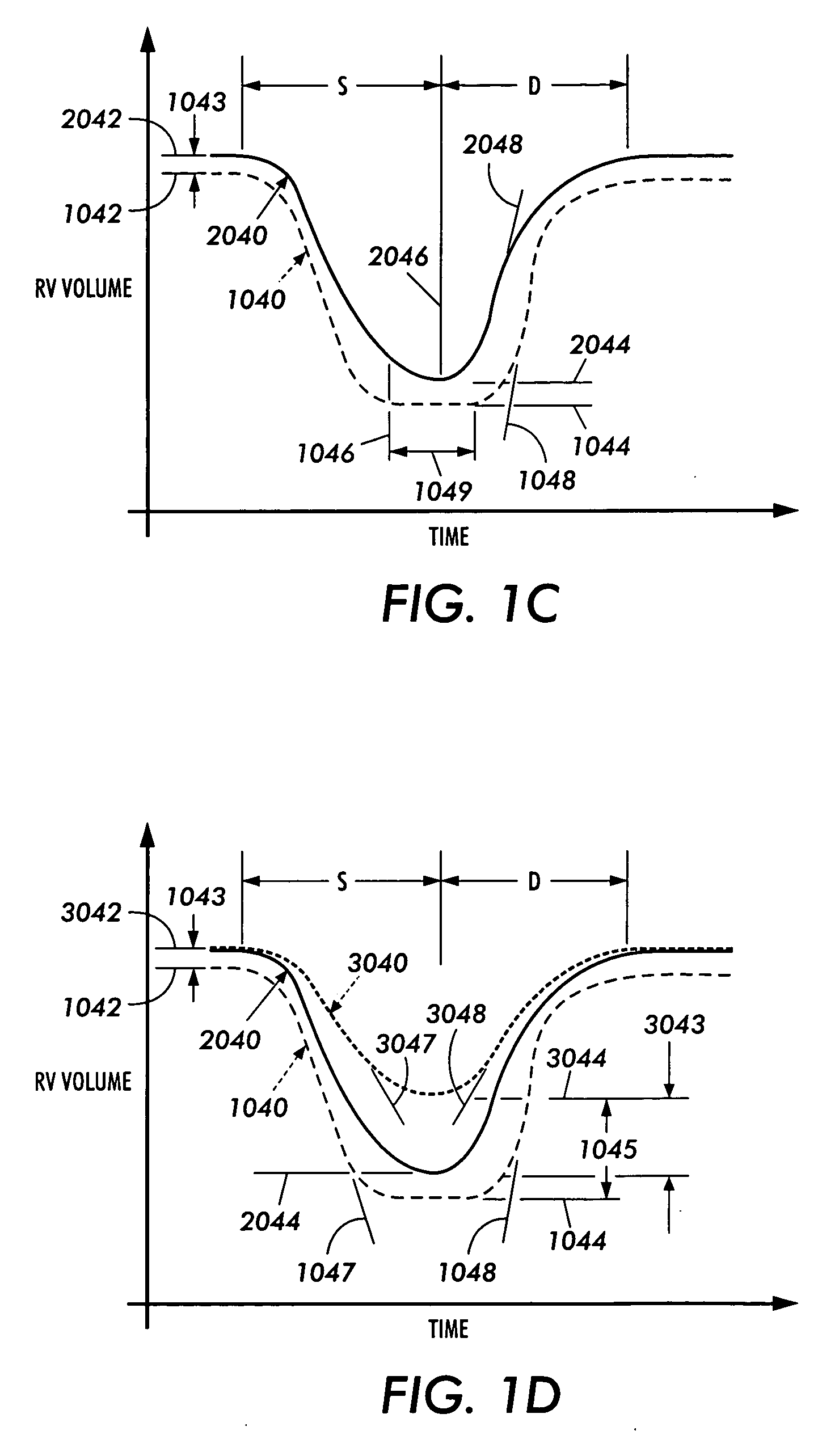 Method and apparatus for direct mechanical ventricular actuation with favorable conditioning and minimal heart stress