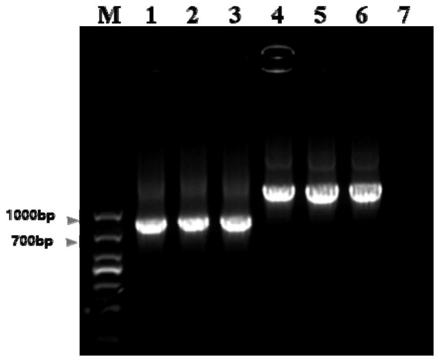 Plasmid for verifying influence of human gene Intron variation on gene splicing and construction method and application thereof