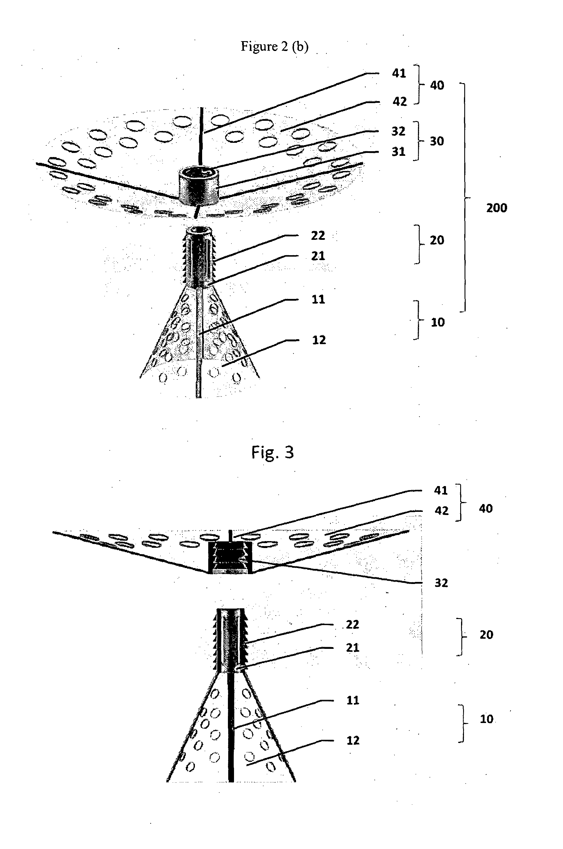 A device and method for forming an anastomotic joint between two parts of a body
