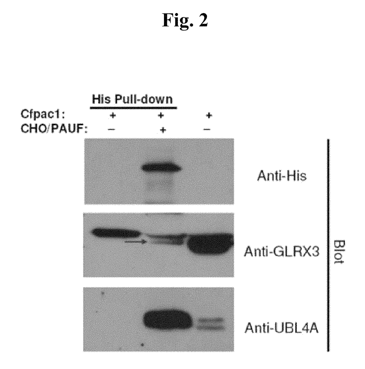 Method for screening for a cancer treatment agent using the interaction between PAUF and a binding partner thereof