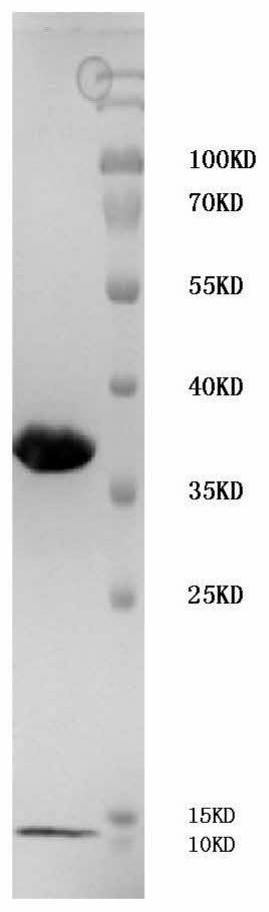 Tumor antigen short peptide derived from prame