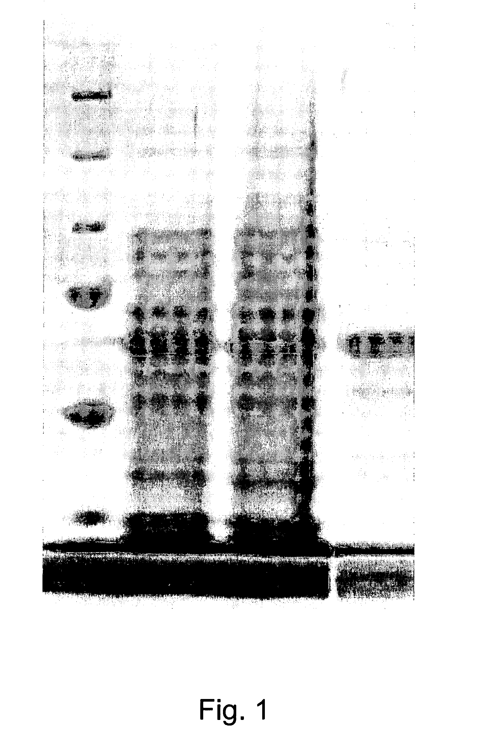 Use of recombinant heat shock protein complexed to kidney cancer antigen