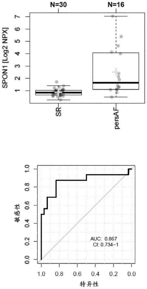 Circulating spon-1 (spondin-1) in the assessment of atrial fibrillation