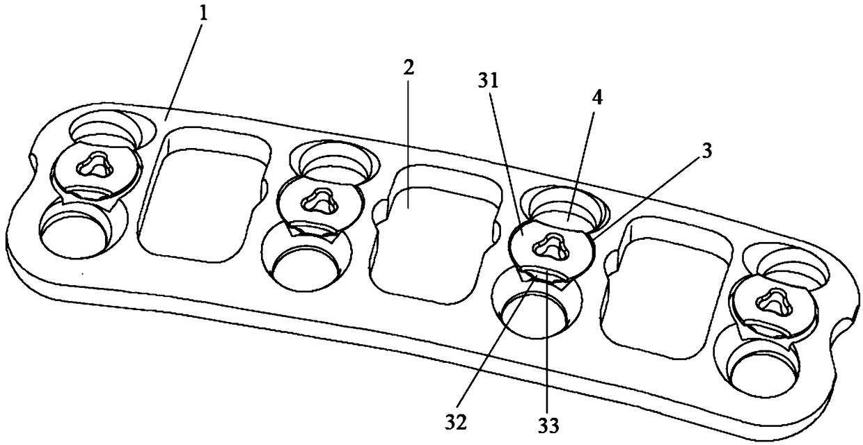 Anterior fixation fusion system for natural height of cervical vertebra