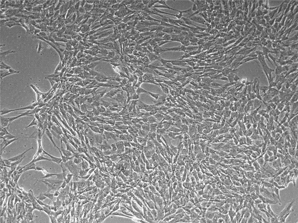 Low serum medium for cultivating human mesenchymal stem cells