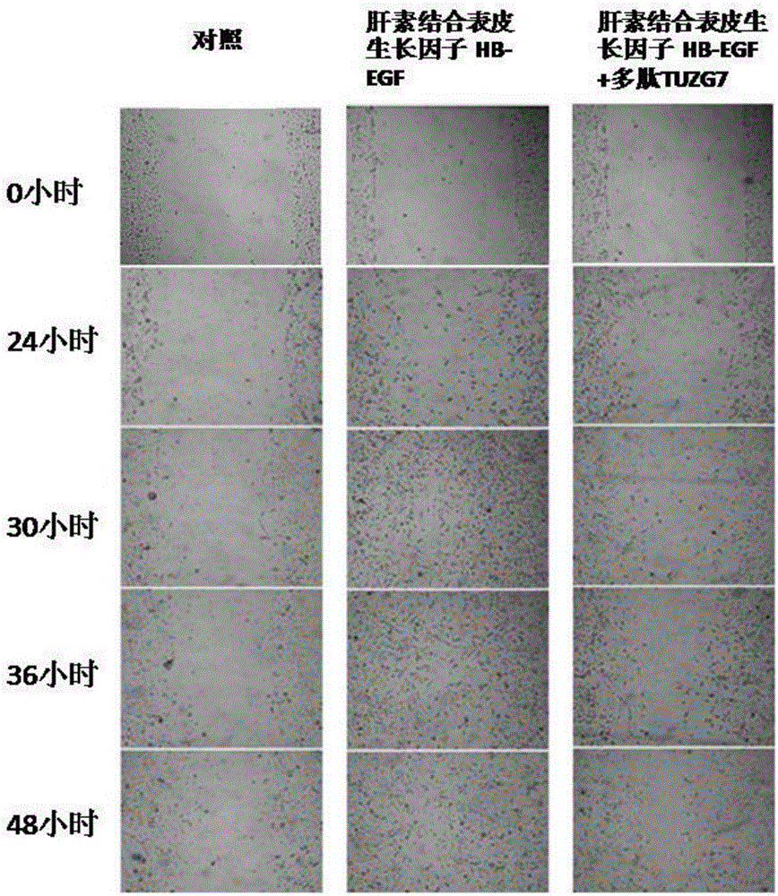 Polypeptide with specificity inhibiting HB-EGF promoting tumor cell migration and infiltration