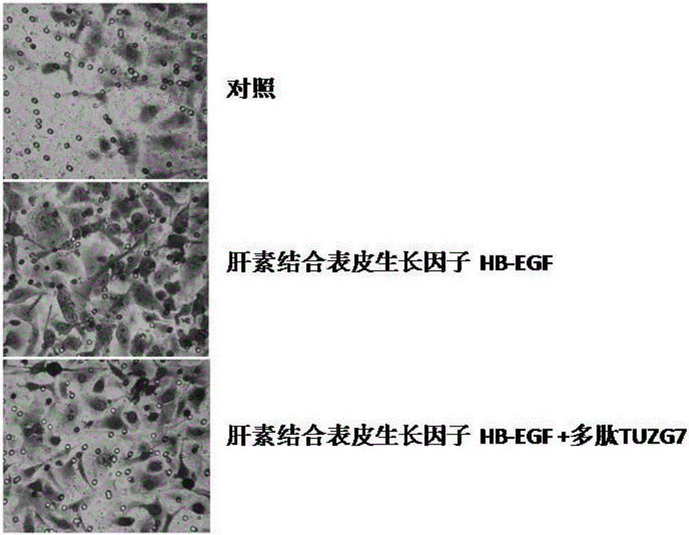 Polypeptide with specificity inhibiting HB-EGF promoting tumor cell migration and infiltration