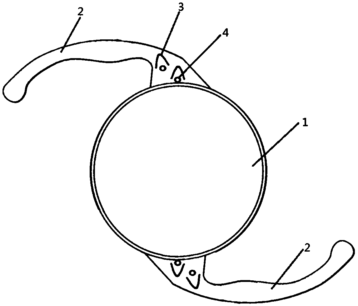 Anterior capsule opening auxiliary fixed artificial lens