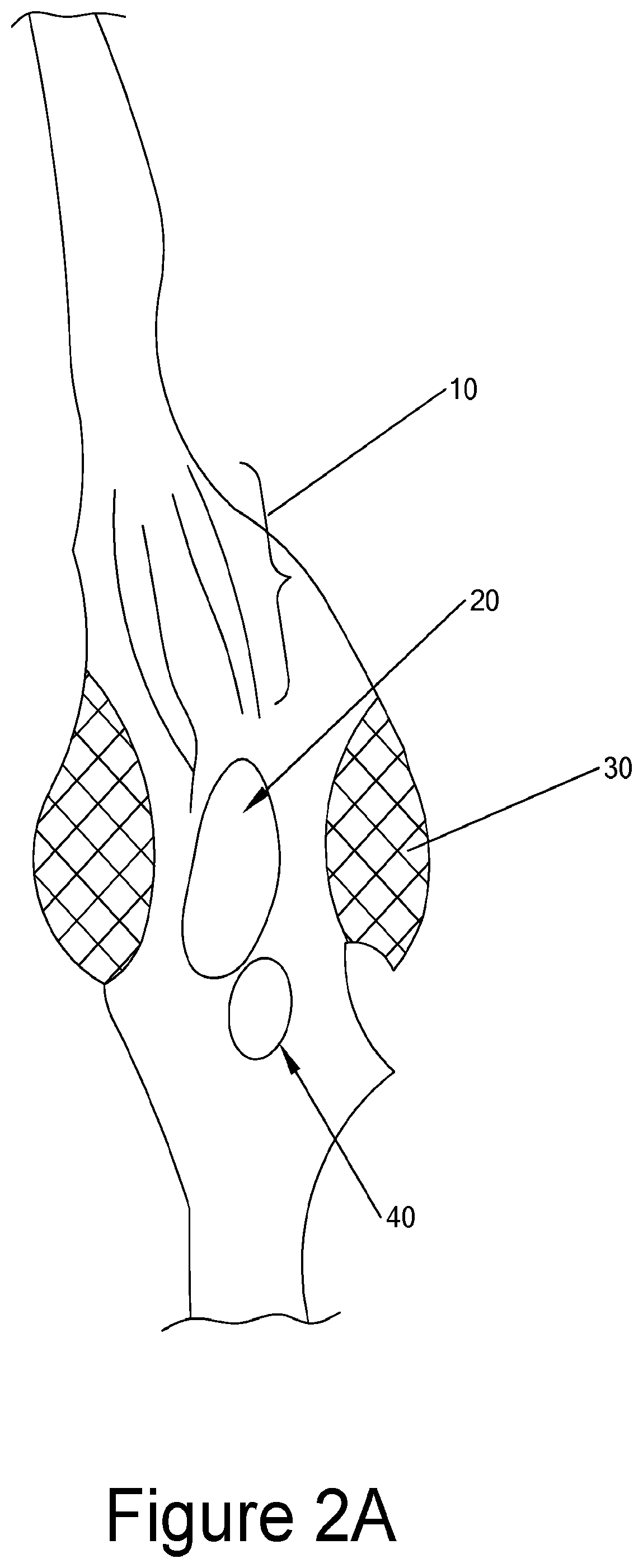 Modified animal organs for use in surgical simulators