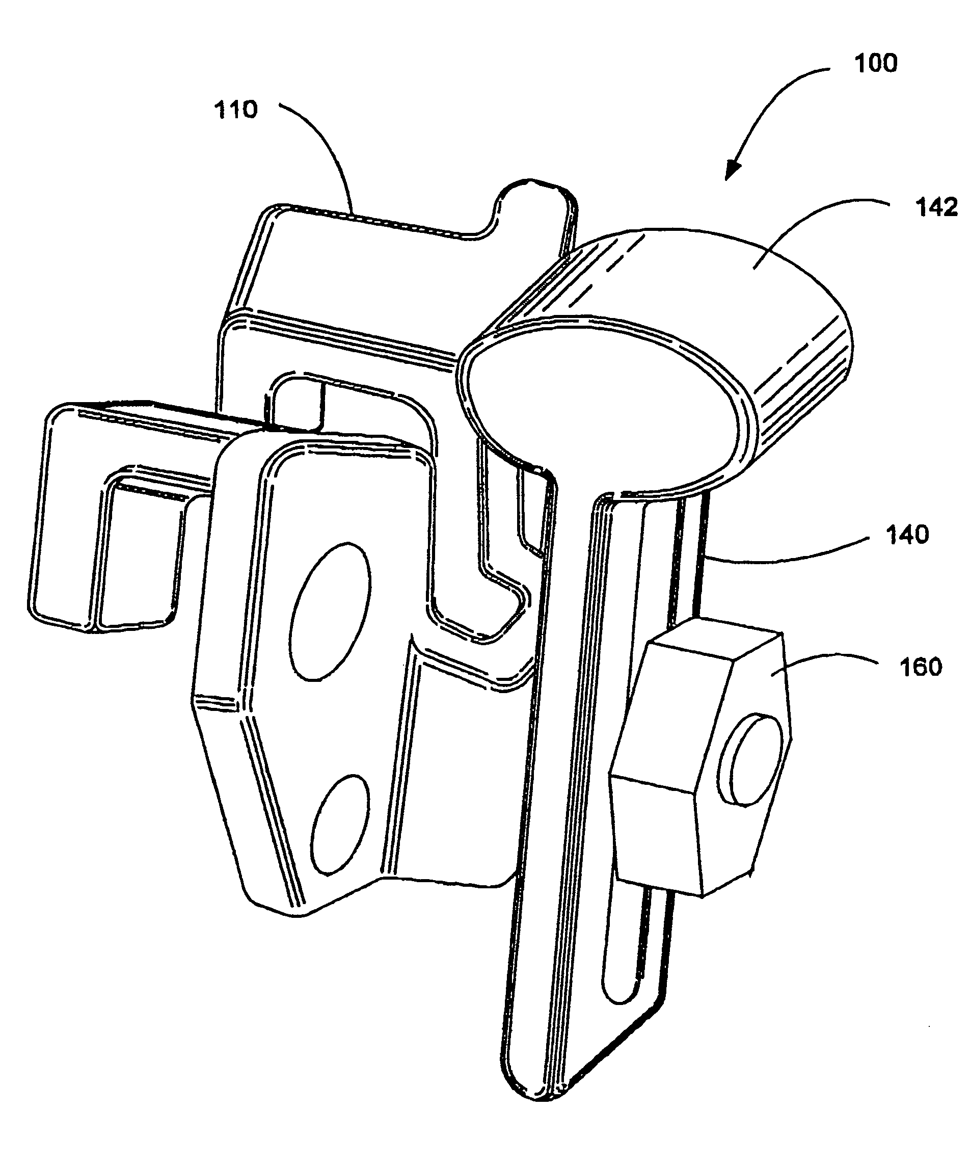 Interspinous process and sacrum implant and method