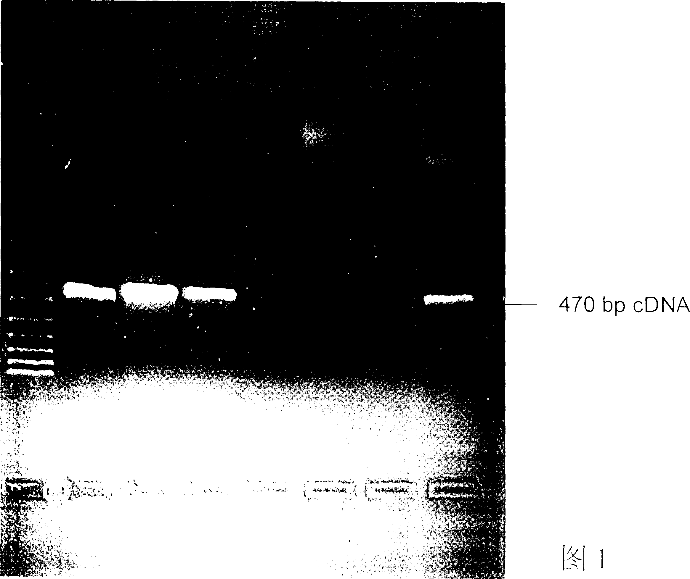 Human anti-tetanotoxin monoclonal antibody, method for preparation and application