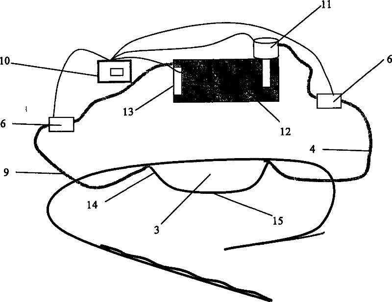 Sourd transparent intestinal canal pushing apparatus for high-strength focusing supersonic wave treatment