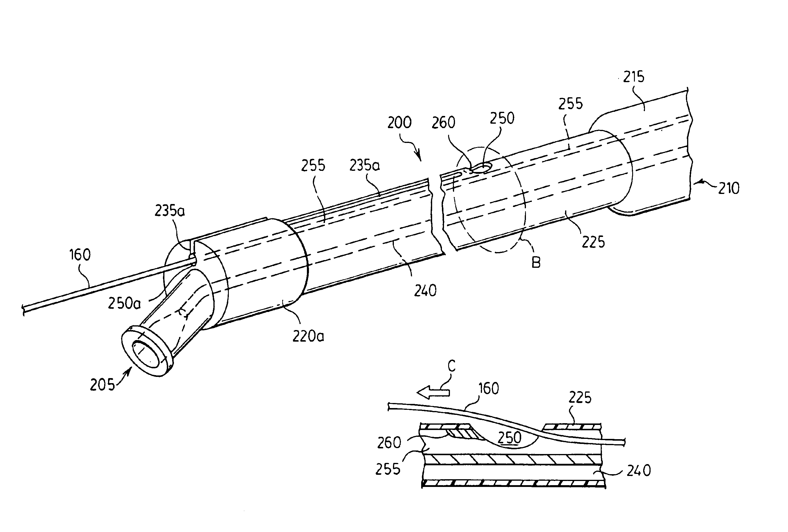 Stent delivery system and method of use