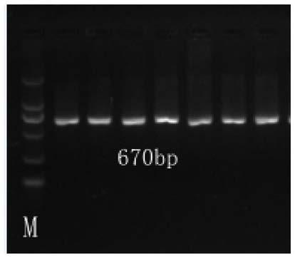 Molecular marker and its application of gene svep1 related to eye muscle pH value 24 hours after slaughter