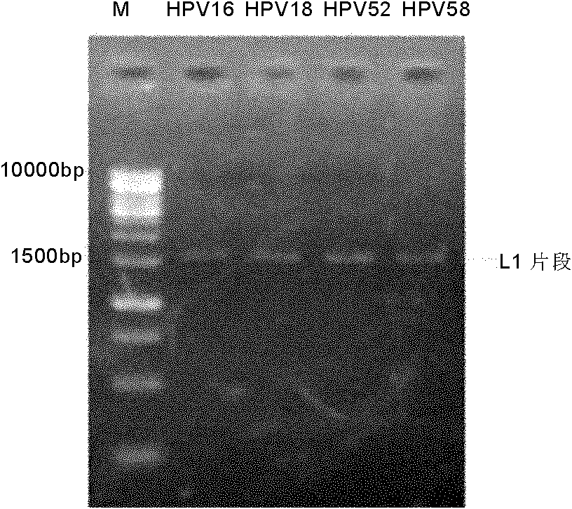 Vaccine against human papillomavirus (HPV) as well as preparation method and application thereof