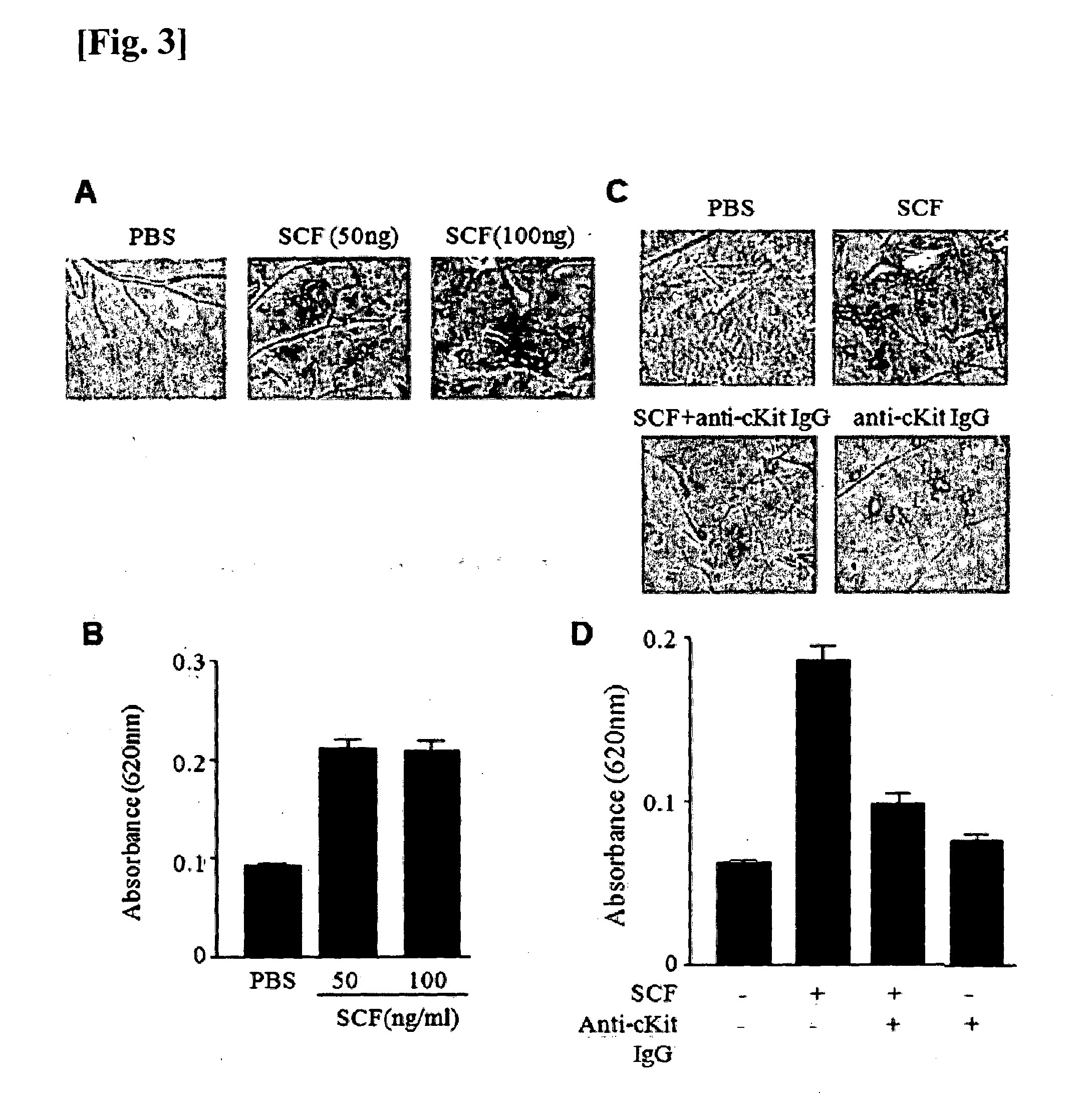 Composition comprising material for inhibiting scf or receptor thereof for treating or preventing diseases associated with vascular permeability