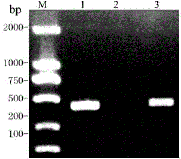 Aureobasidium pullulans dicarboxylic acid transport protein and recombinant vector and application thereof