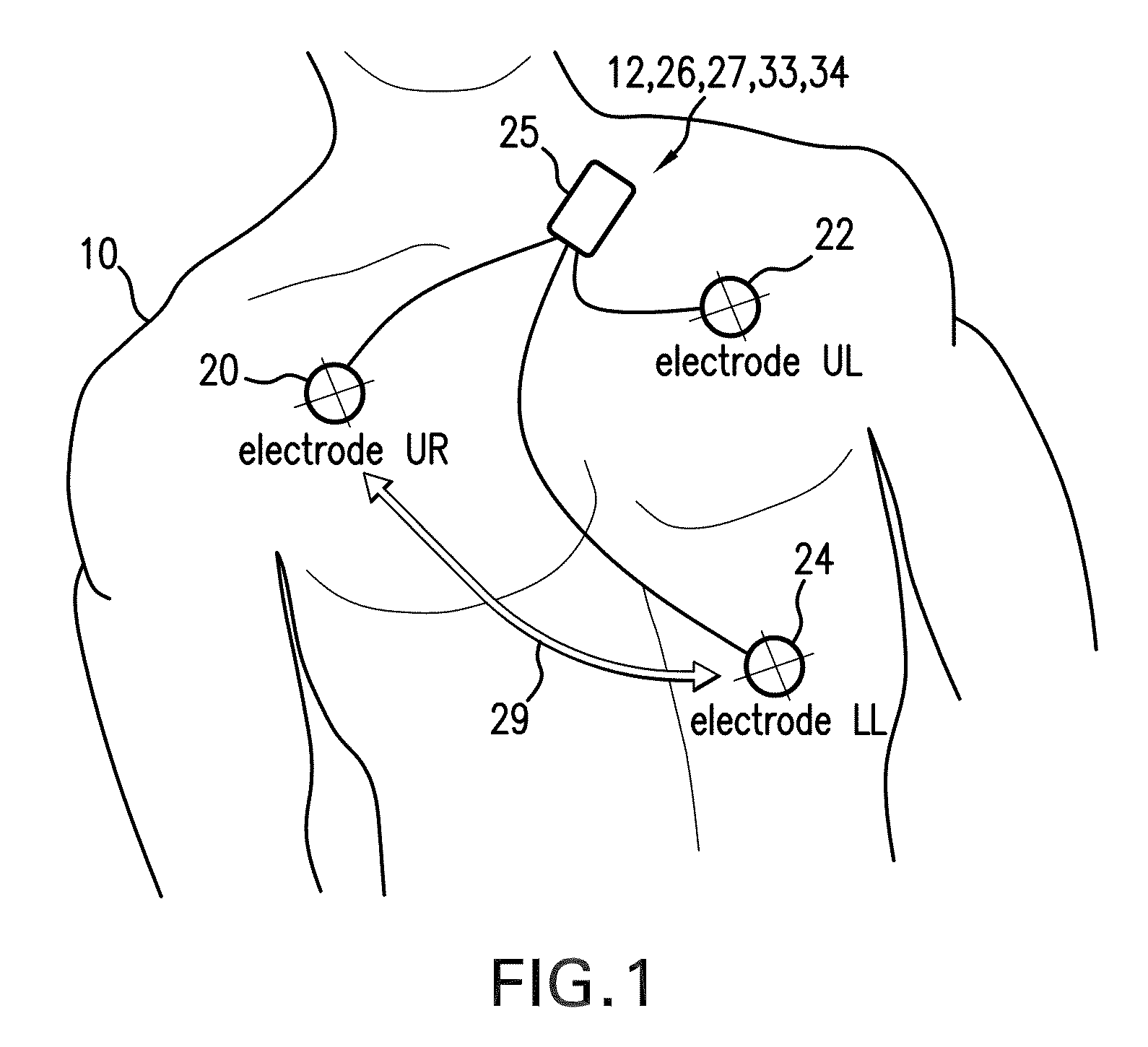 Body-worn monitor for measuring respiratory rate