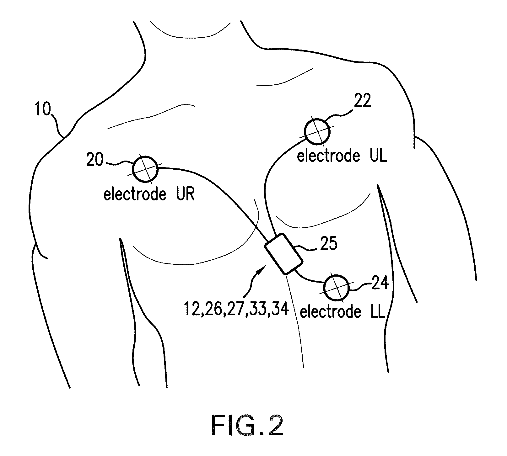 Body-worn monitor for measuring respiratory rate