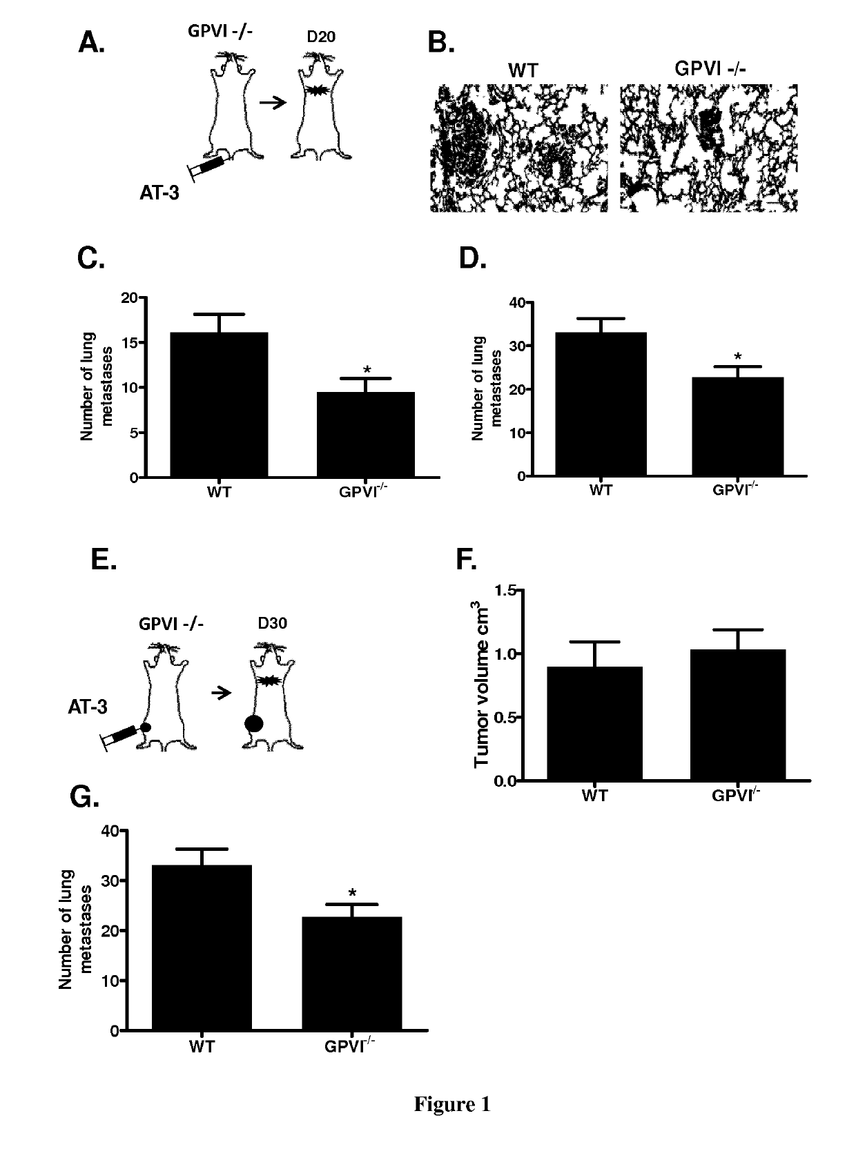 Methods and pharmaceutical compositions for the prophylactic treatment of metastases