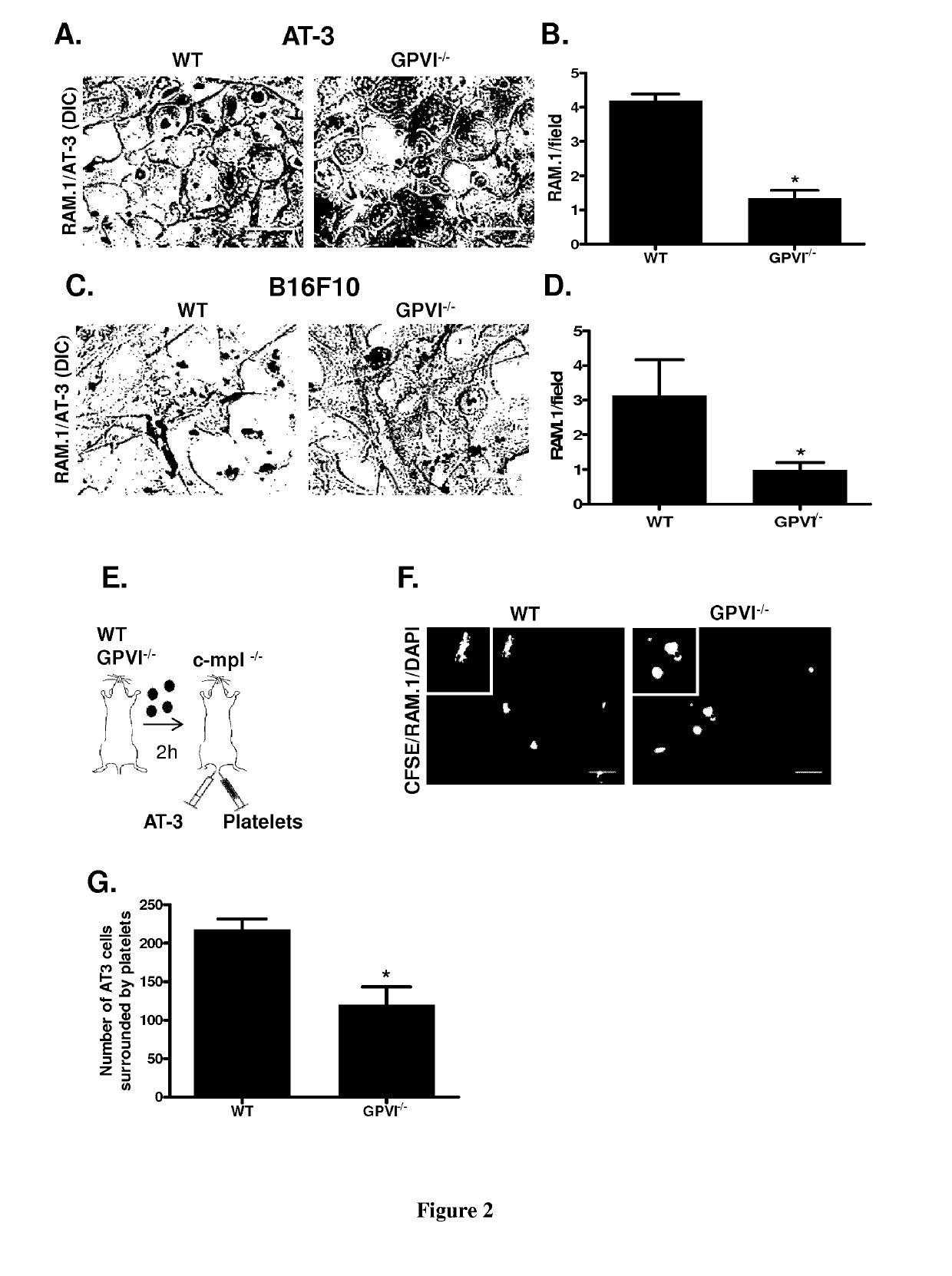 Methods and pharmaceutical compositions for the prophylactic treatment of metastases