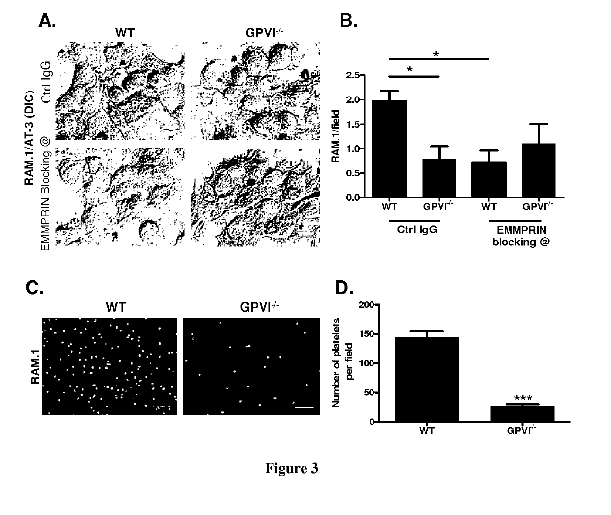 Methods and pharmaceutical compositions for the prophylactic treatment of metastases