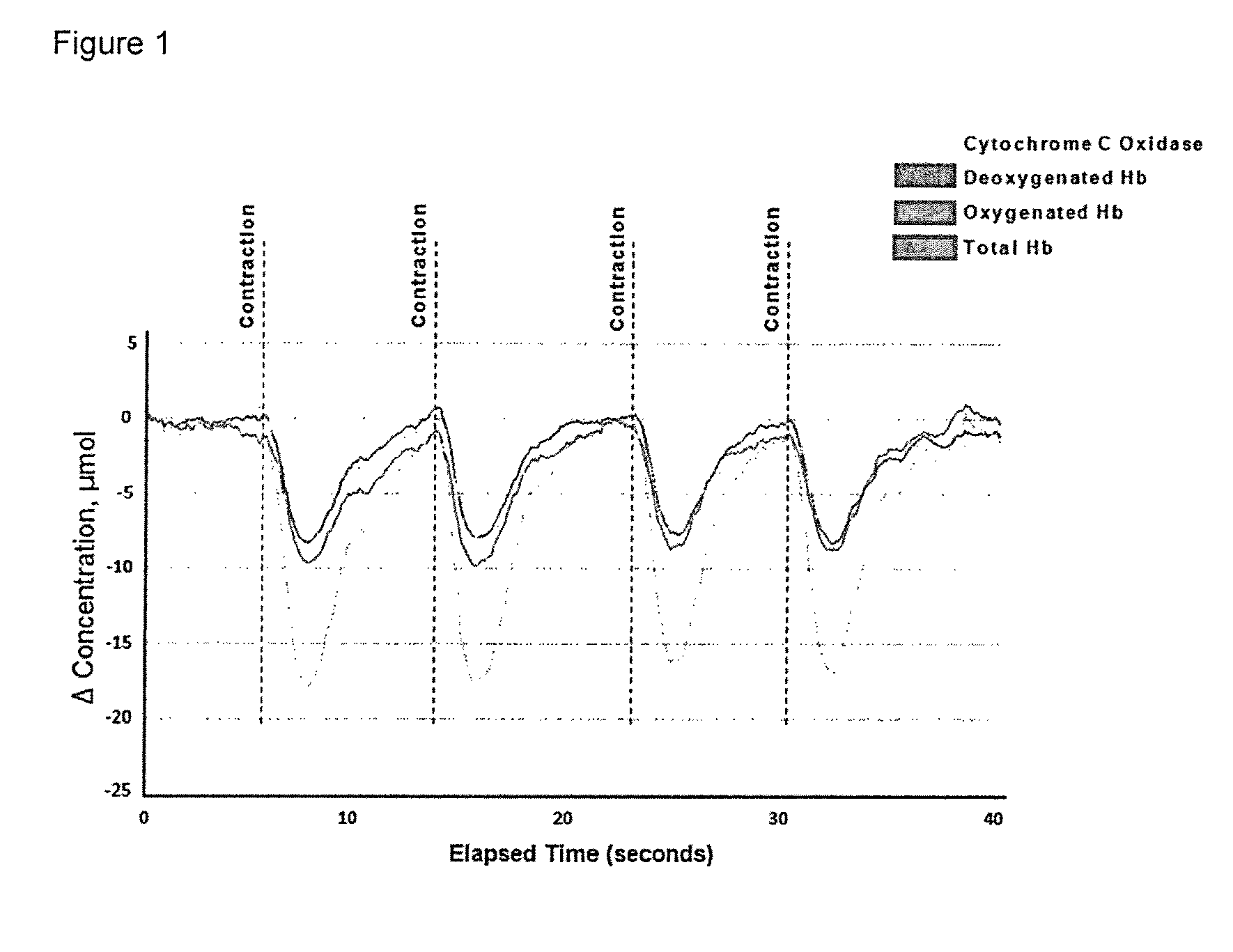 Monitoring urodynamics by trans-vaginal NIRS