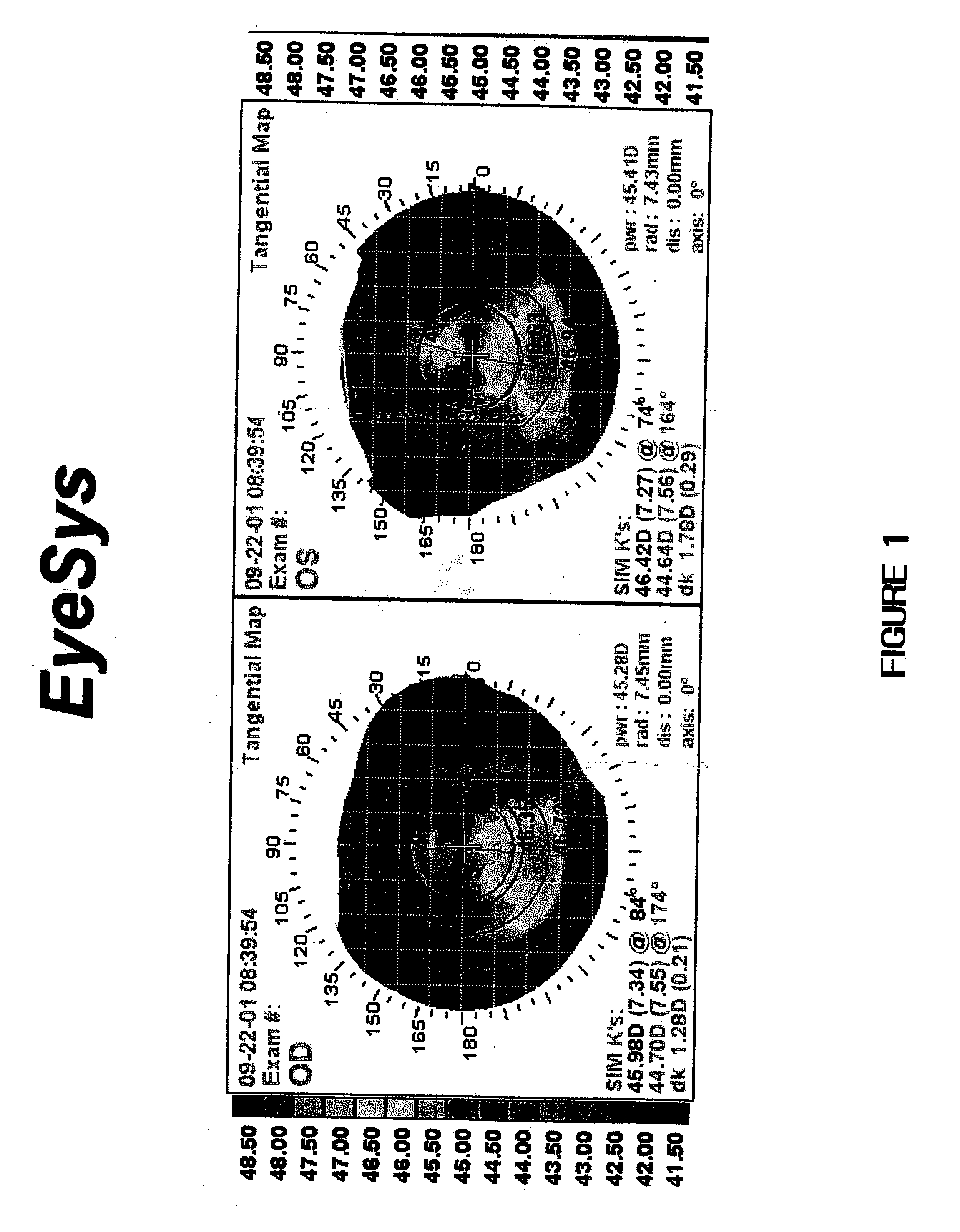 Method for stabilizing changes in corneal curvature in an eye by administering compositions containing stabilizing ophthalmic agents