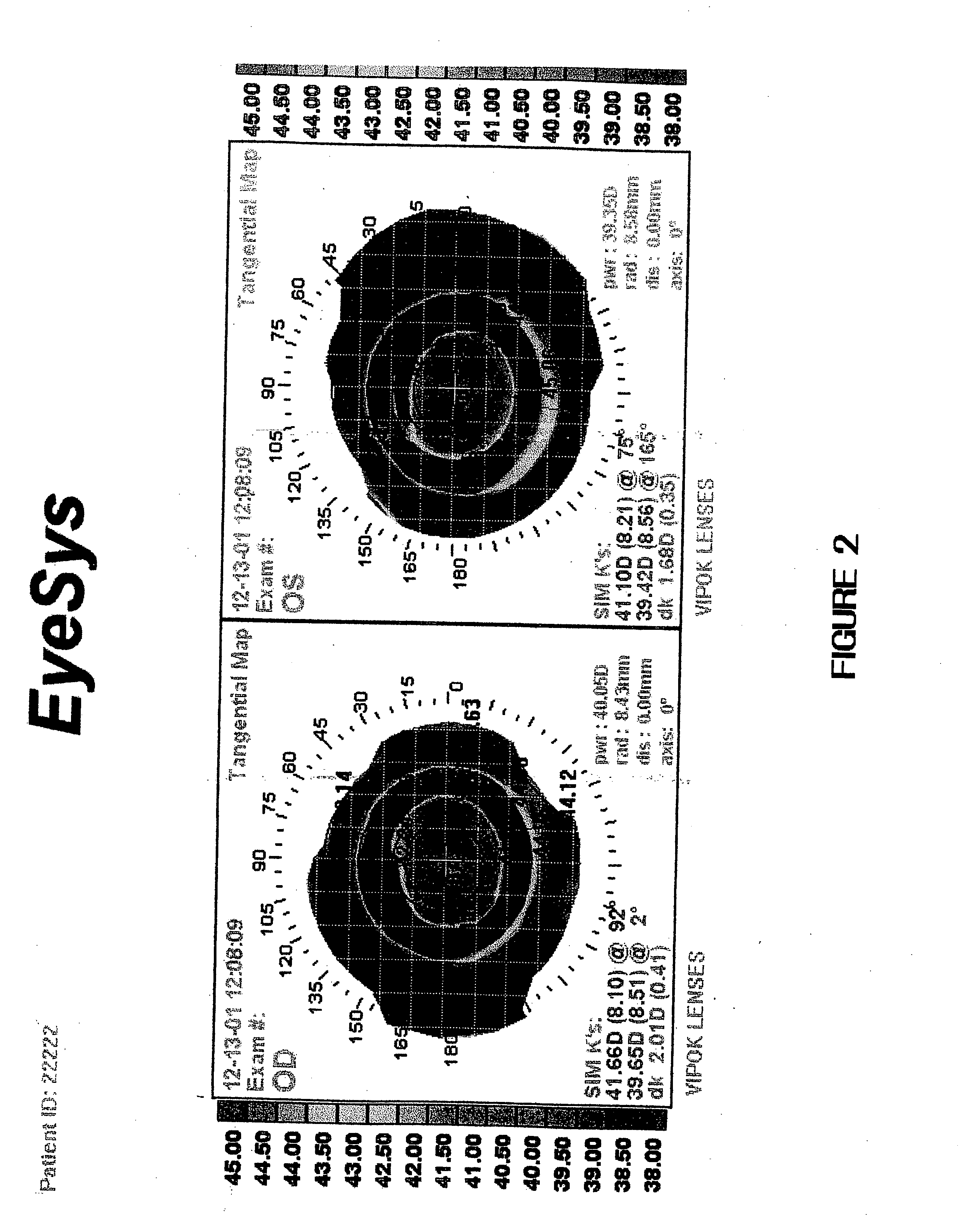 Method for stabilizing changes in corneal curvature in an eye by administering compositions containing stabilizing ophthalmic agents