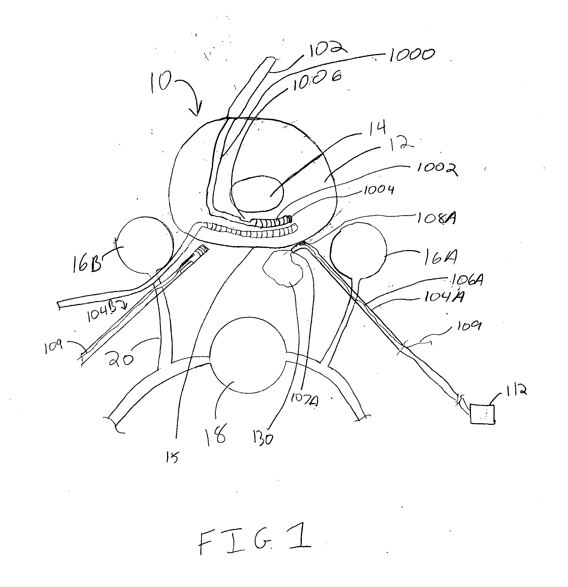 Apparatus and methods for sensing and cooling during application of thermal energy for treating degenerative spinal discs
