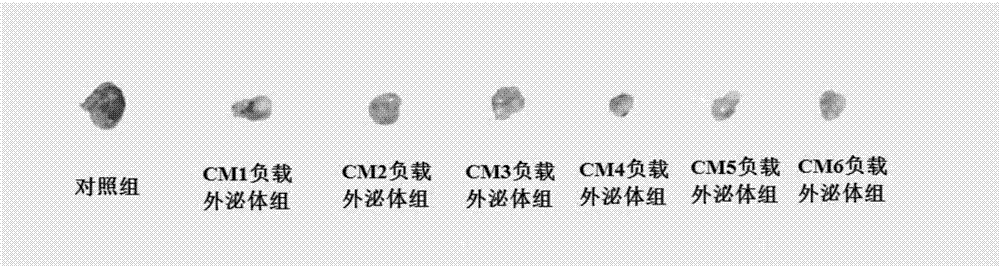Exosome serving as mesenchymal stem cell source and having anti-cancer effect and medicinal preparation thereof