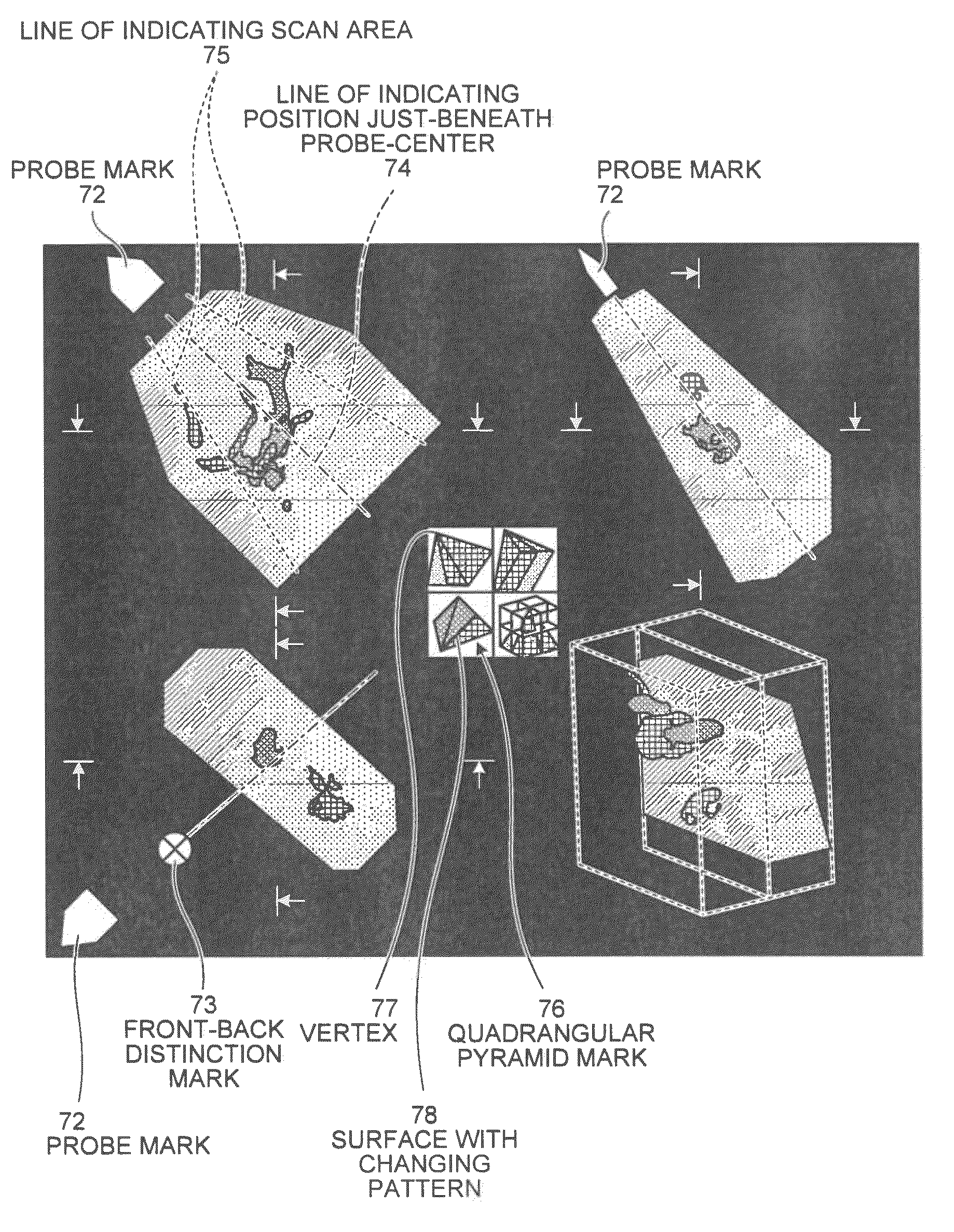 Ultrasound imaging apparatus, image processing apparatus, image processing method, and computer program product