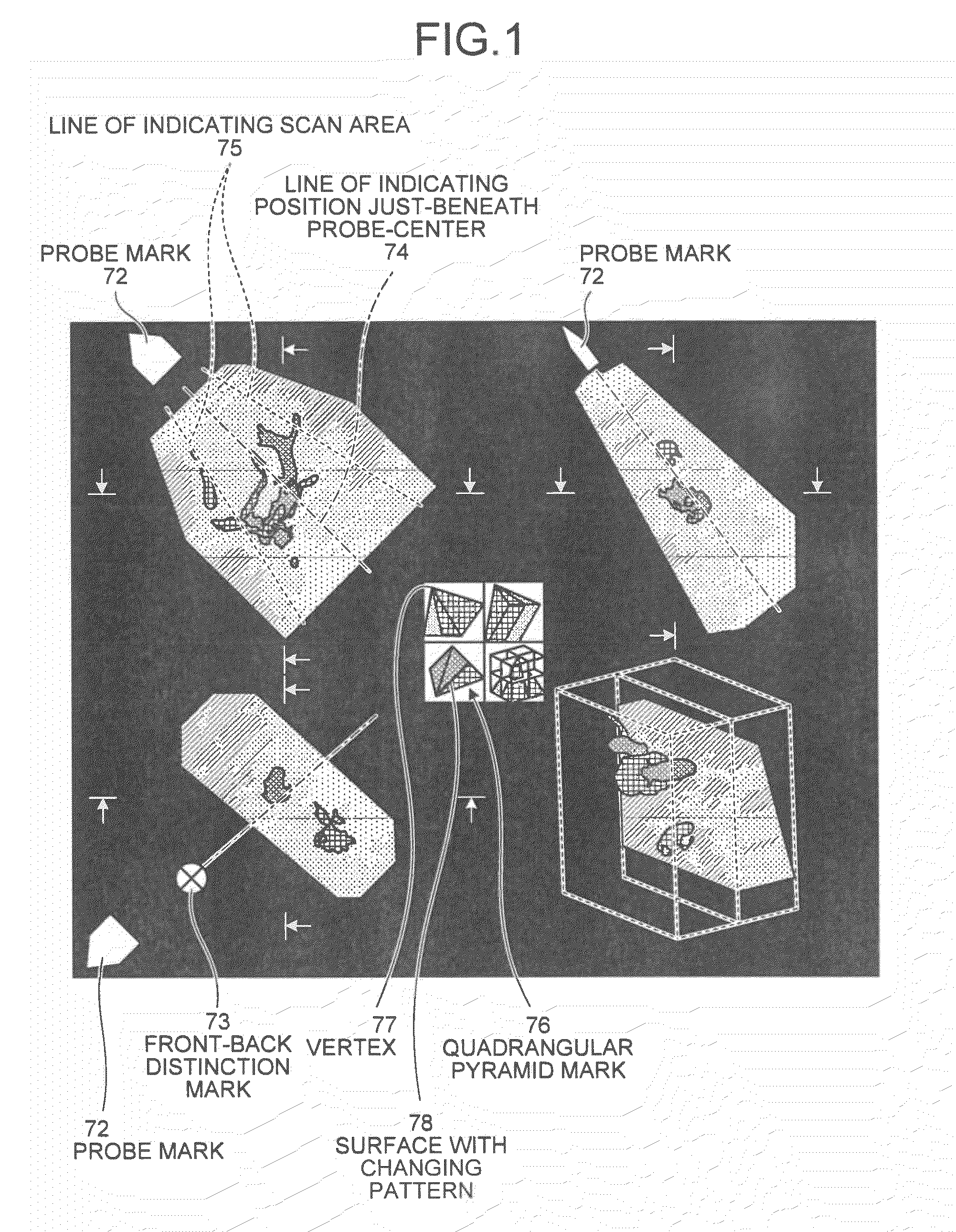 Ultrasound imaging apparatus, image processing apparatus, image processing method, and computer program product