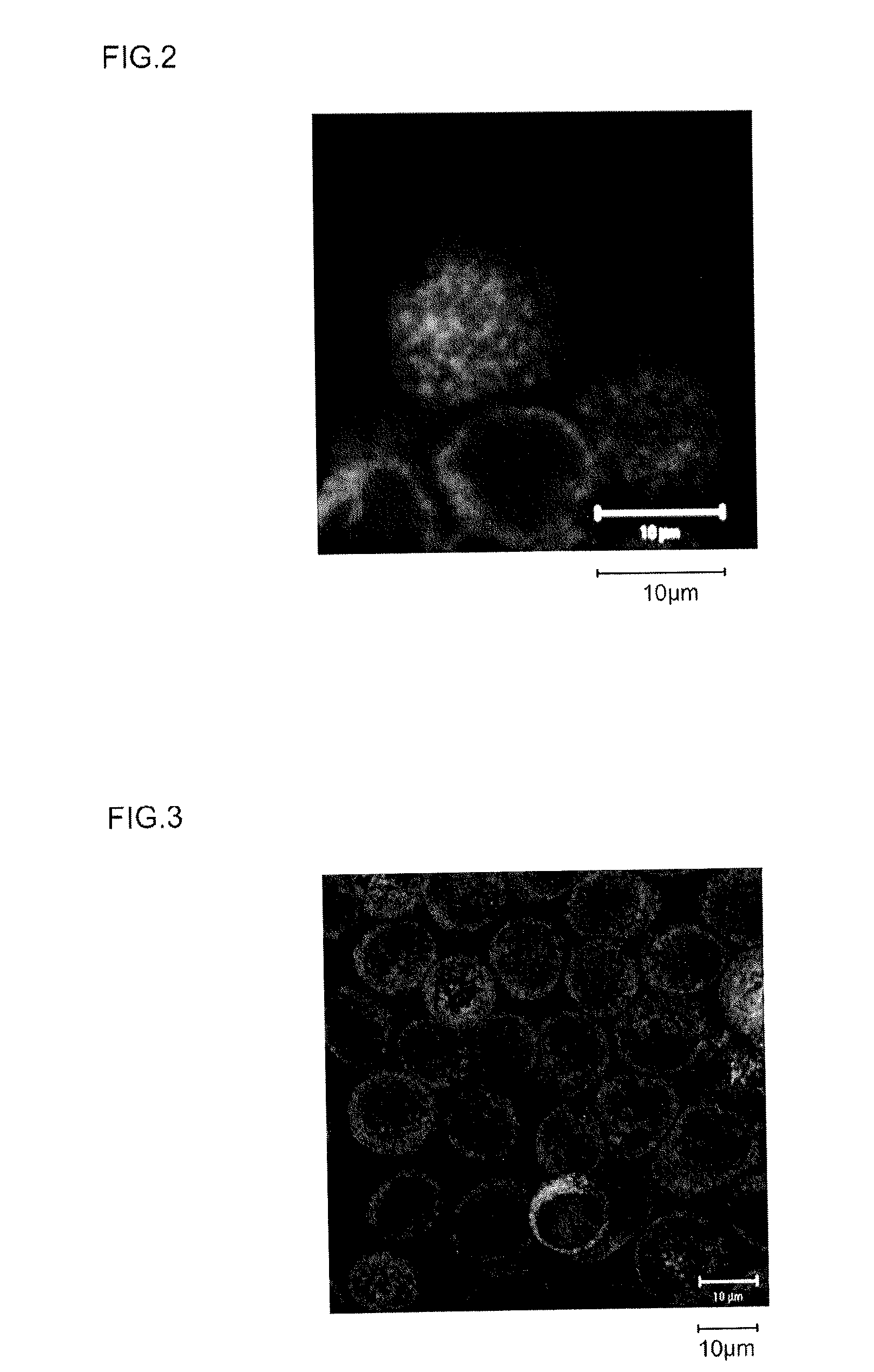 Method for promoting expression of calreticulin, and synthetic peptide for use in method for promoting expression of calreticulin