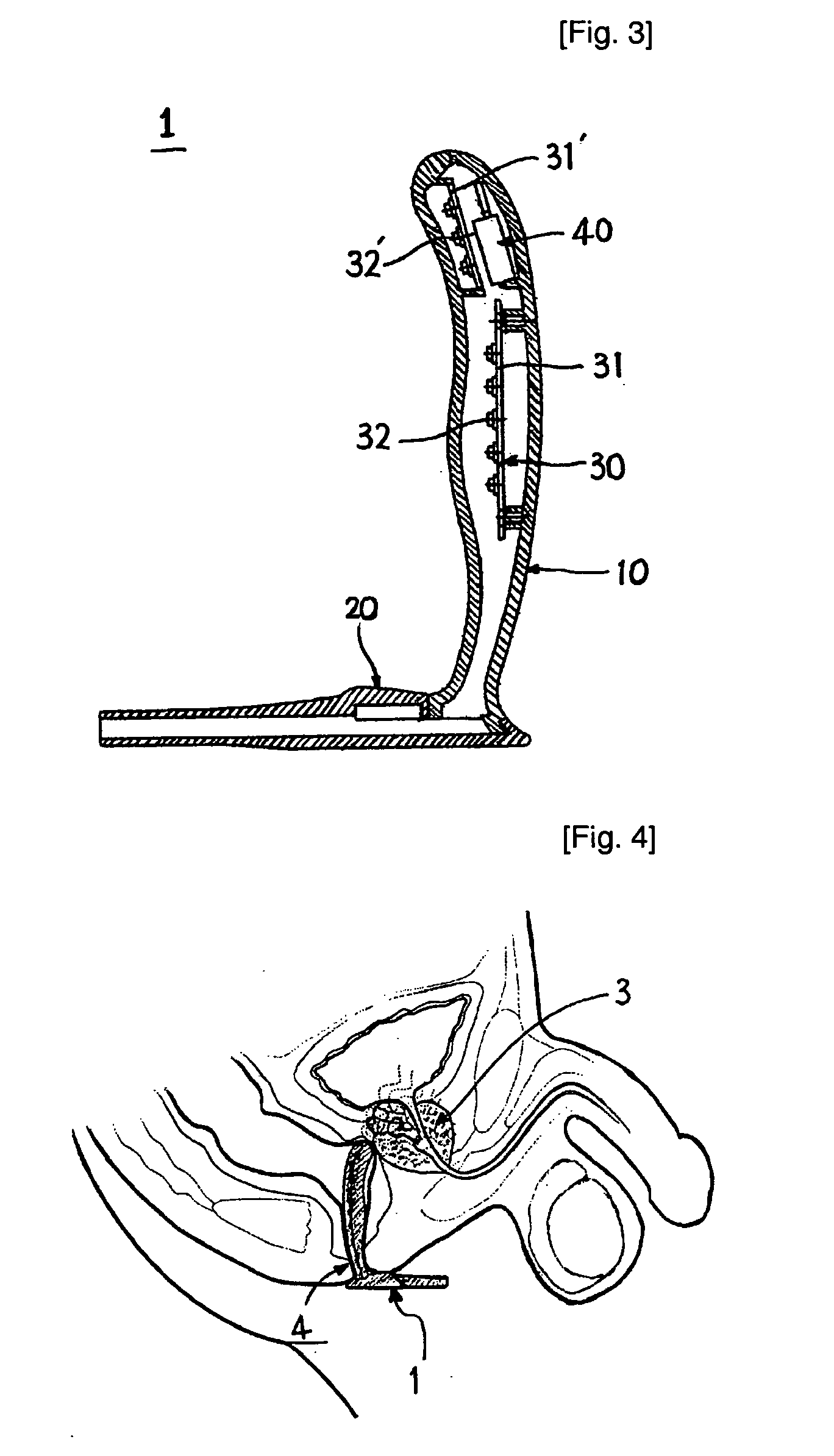Medical device for treating prostate diseases by using near-infrared led