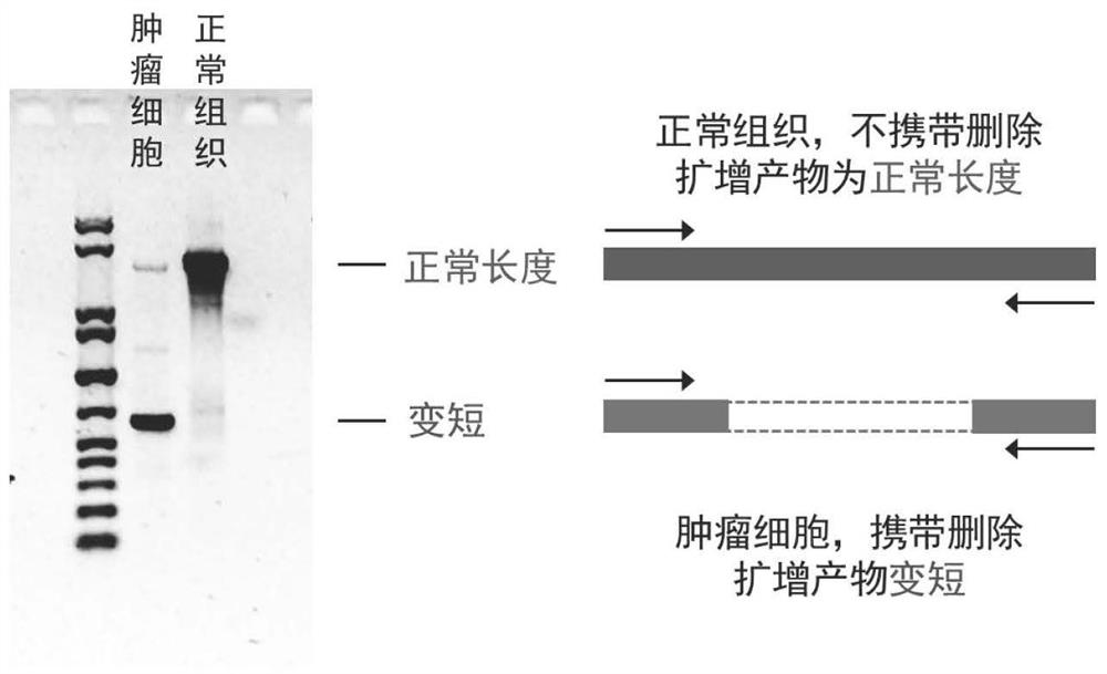 PCR primer group, kit and application thereof