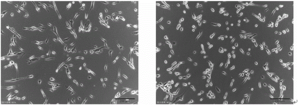 Serum-free medium and method for culturing mesenchymal stem cell
