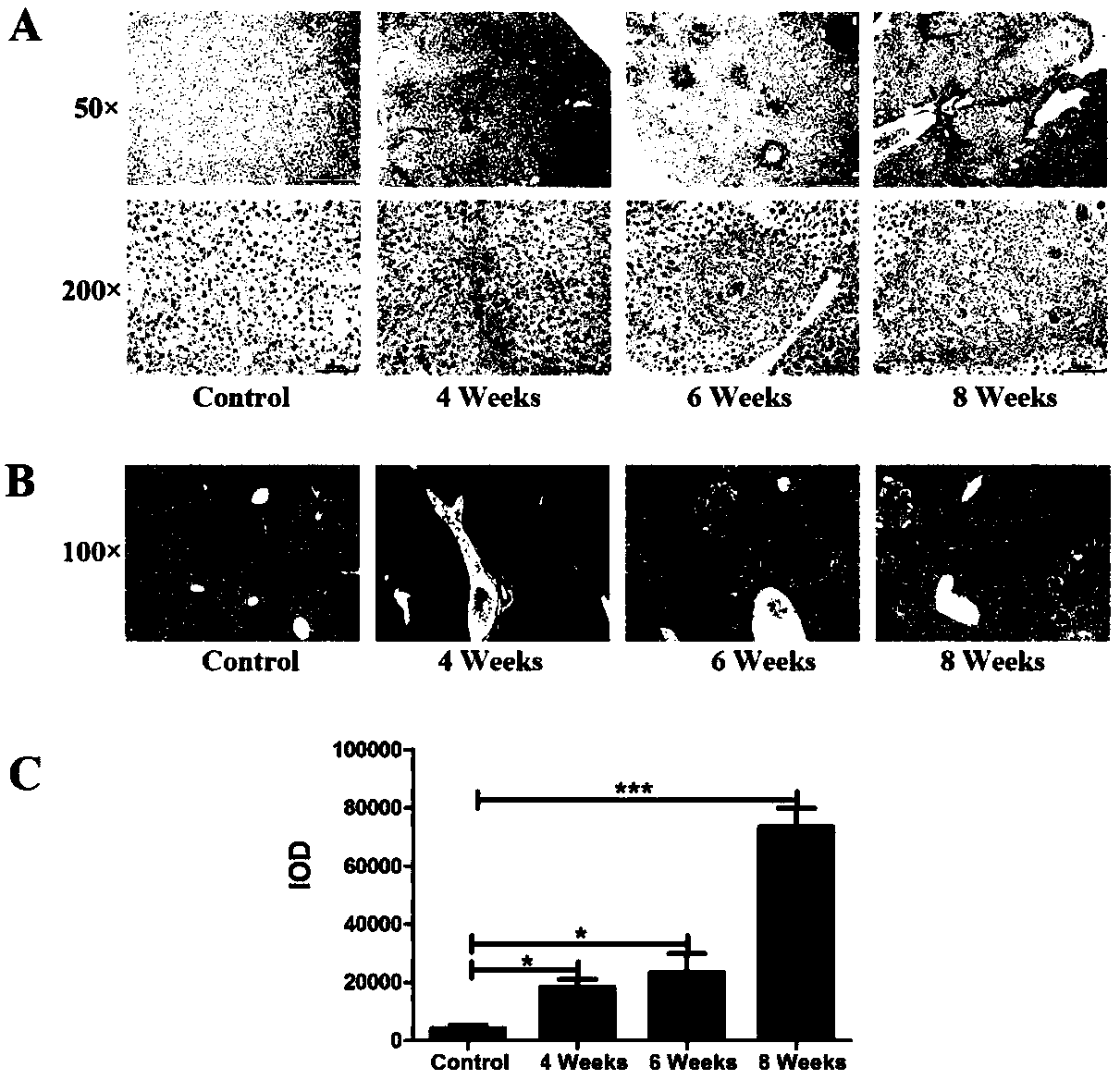 application-of-beta-actin-protein-as-serological-diagnostic-marker-for-hepatic-fibrosis-of