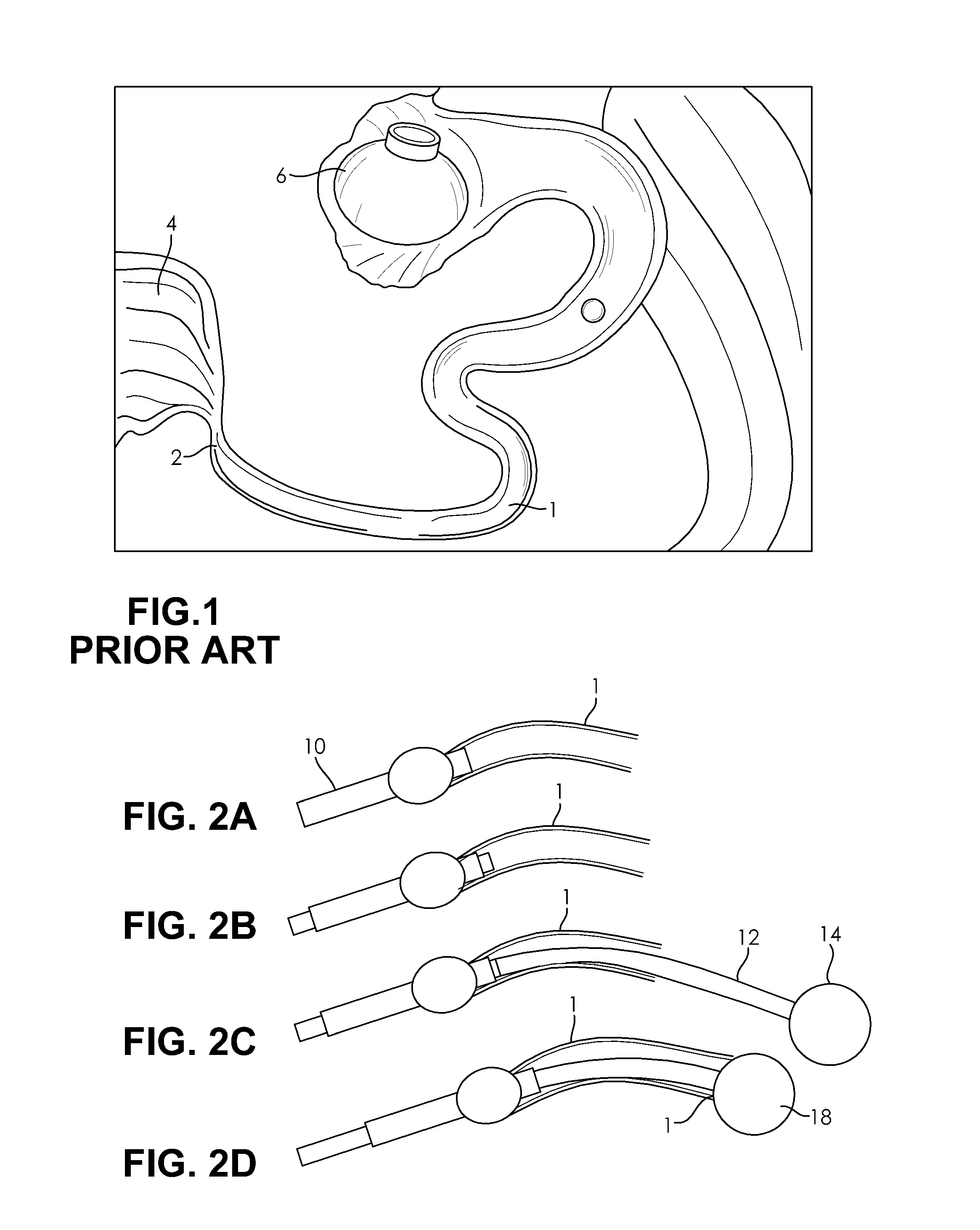 Methods and devices for fallopian tube diagnostics