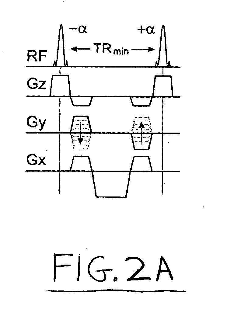 Method and apparatus for generation of magnetization transfer contrast in steady state free precession magnetic resonance imaging