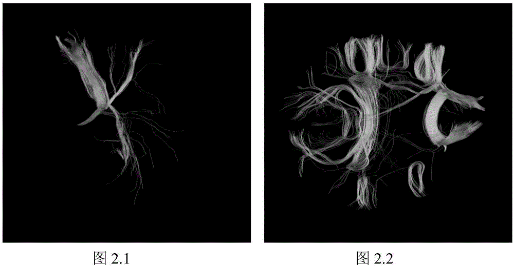 Brain fiber clustering method based on space path similarity